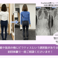 側弯症ピラティスの変化