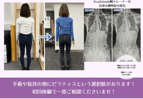 側弯症ピラティスの変化