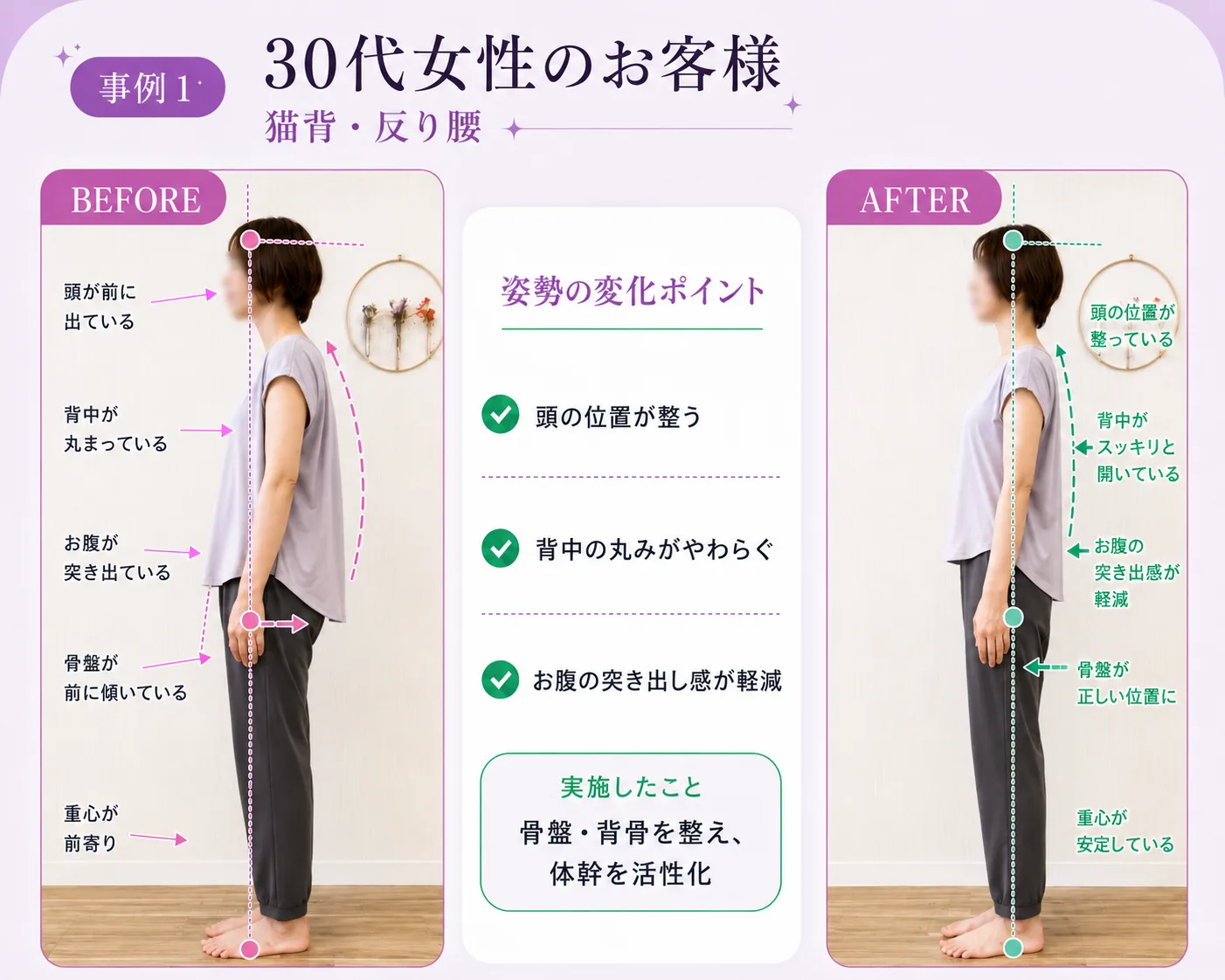 30代女性のお客様のビフォーアフター（モデル）