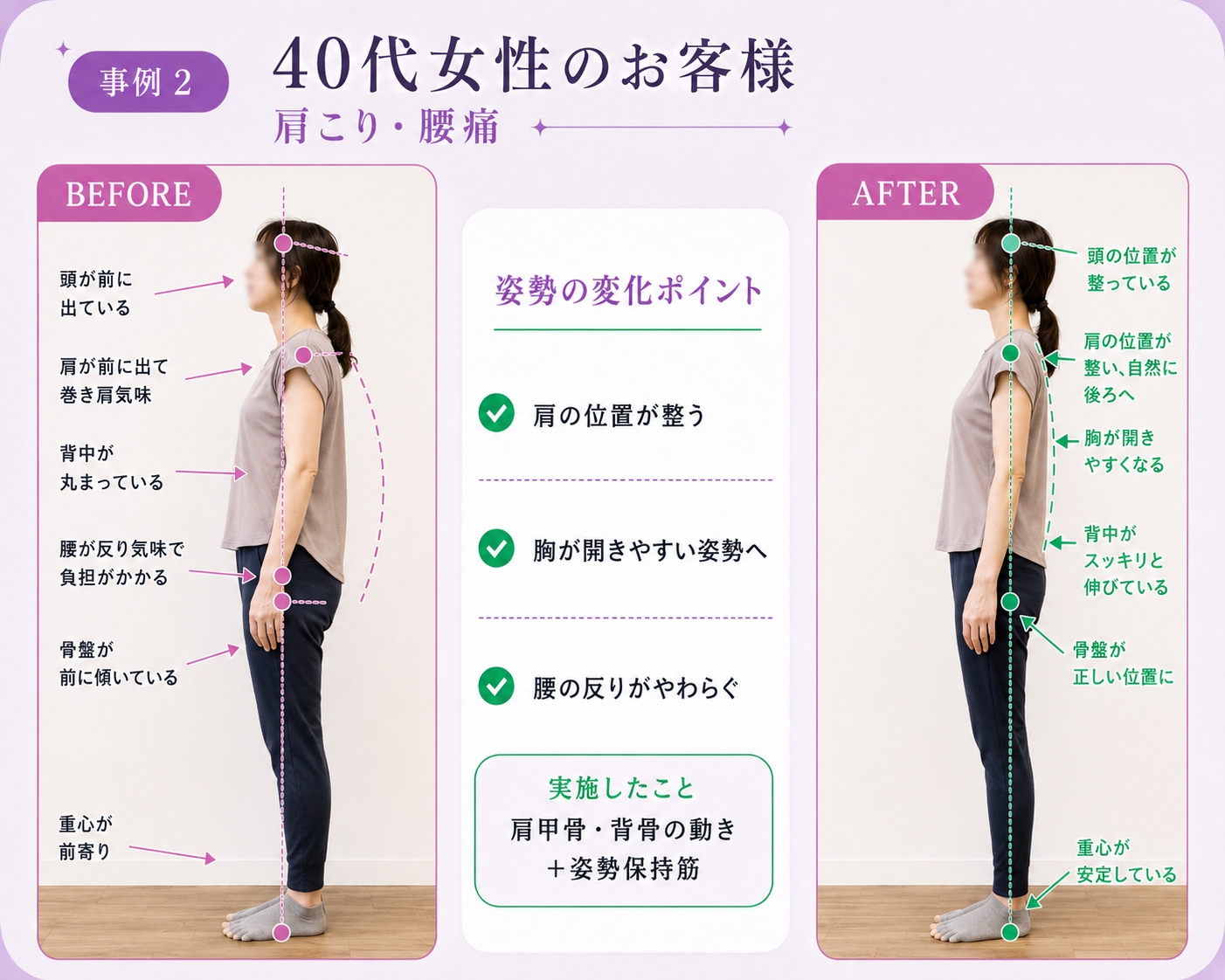 40代女性のお客様のビフォーアフター（モデル）