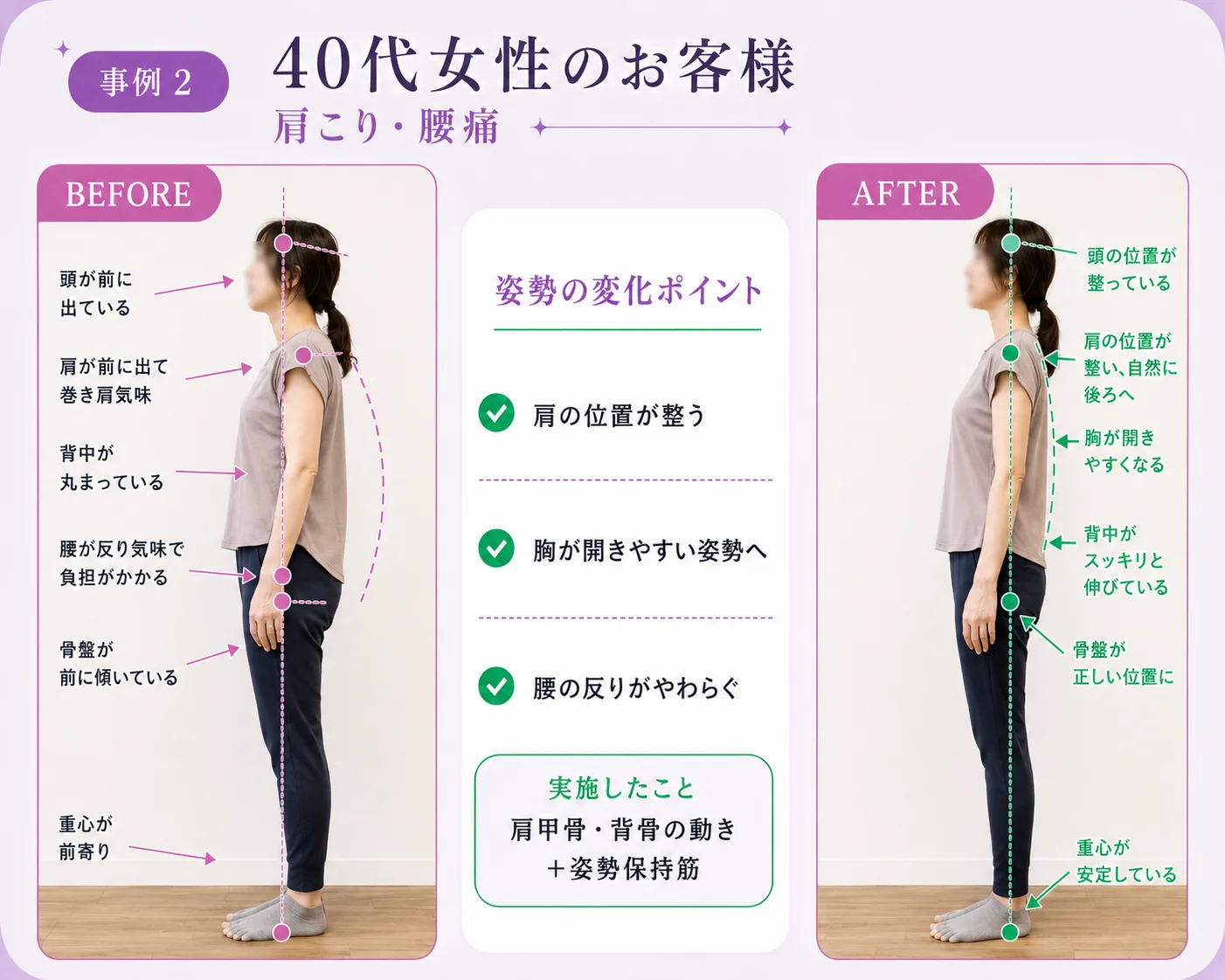 40代女性のお客様のビフォーアフター（モデル）