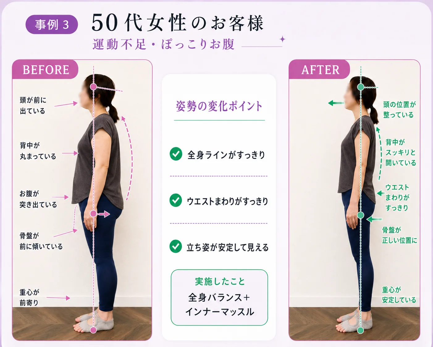 50代女性のお客様のビフォーアフター（モデル）